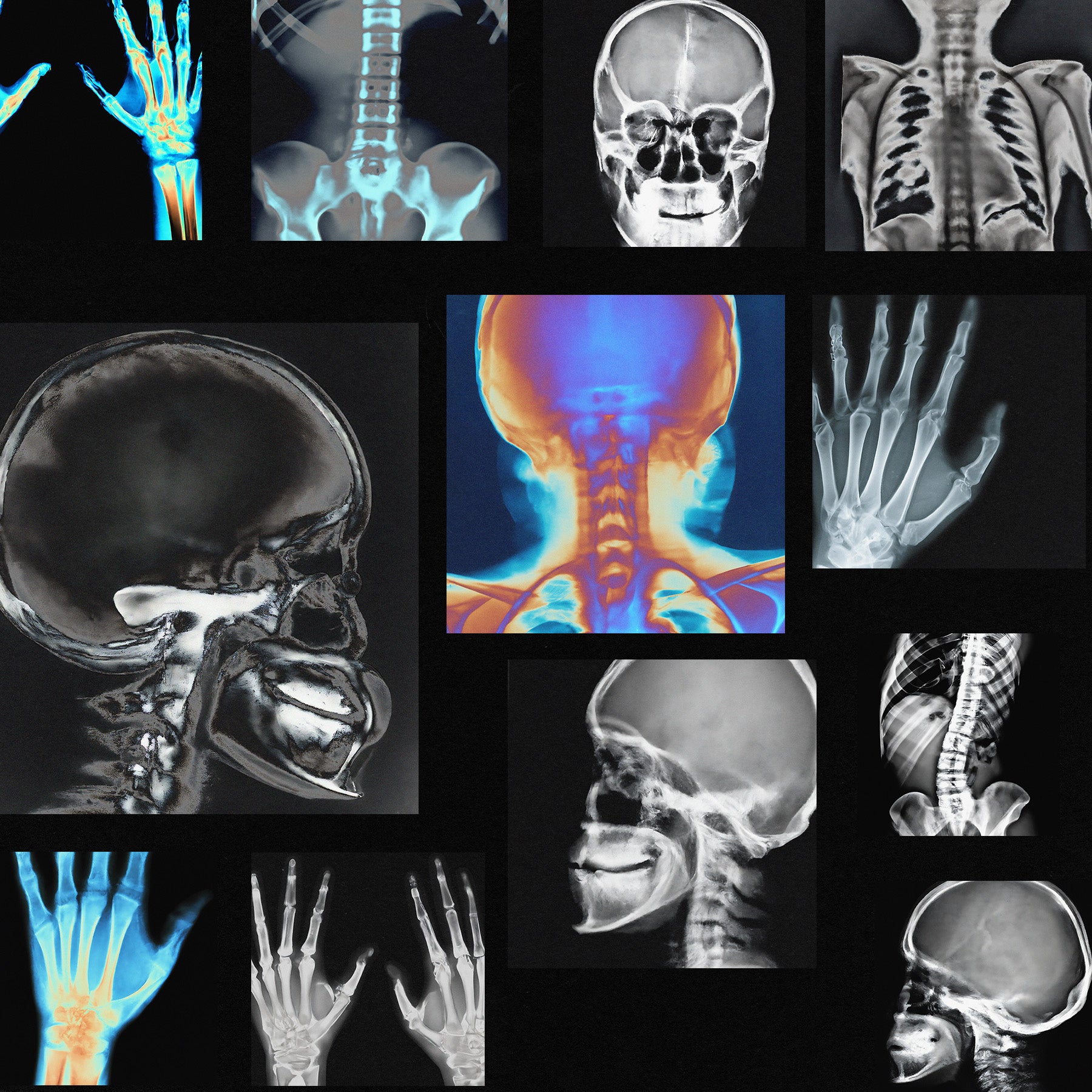 X-RAY SCANS