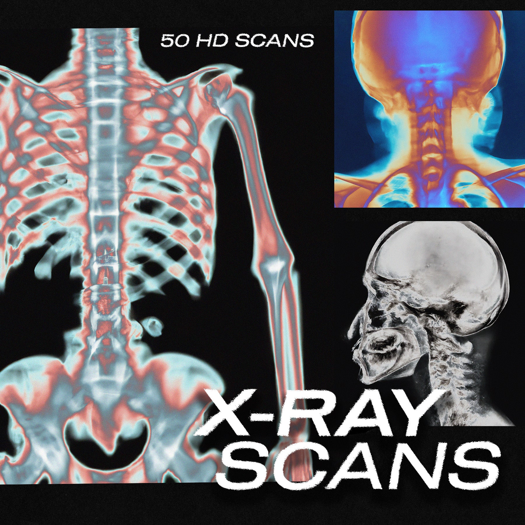 X-RAY SCANS