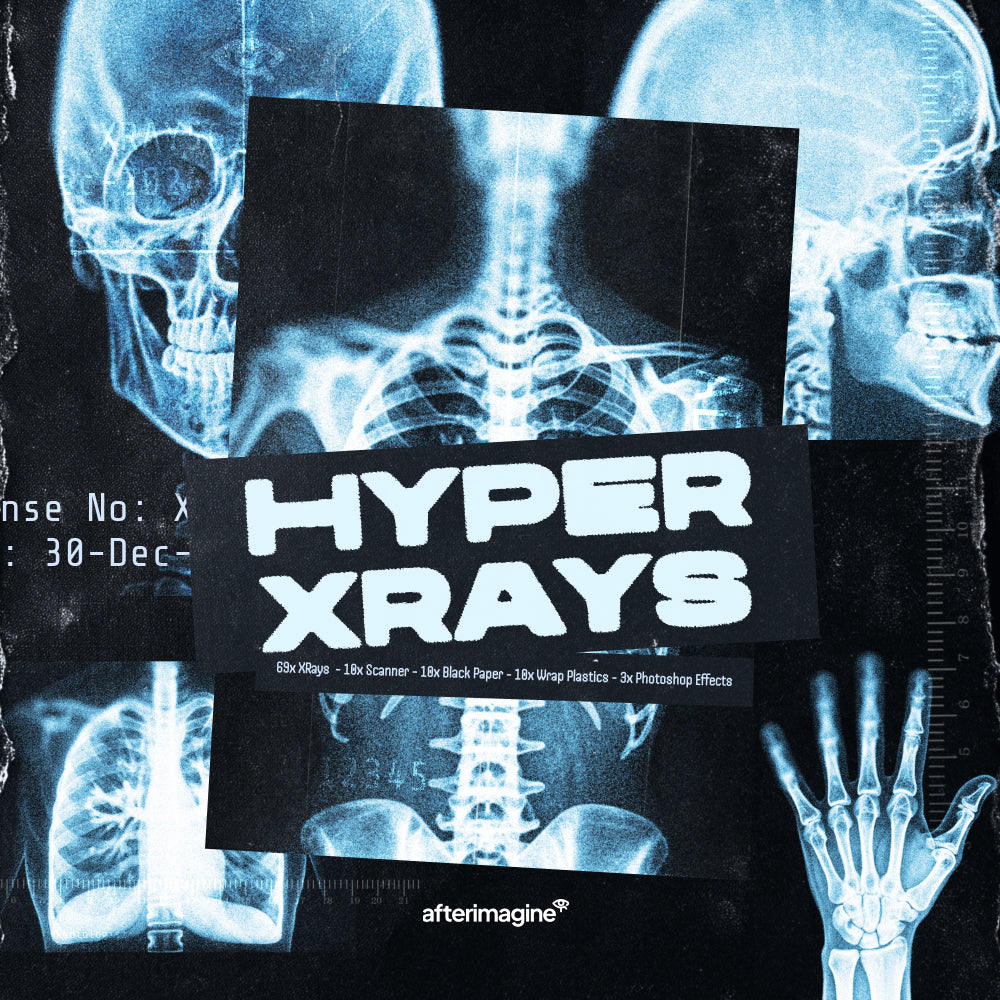Hyper XRays - secret-cache