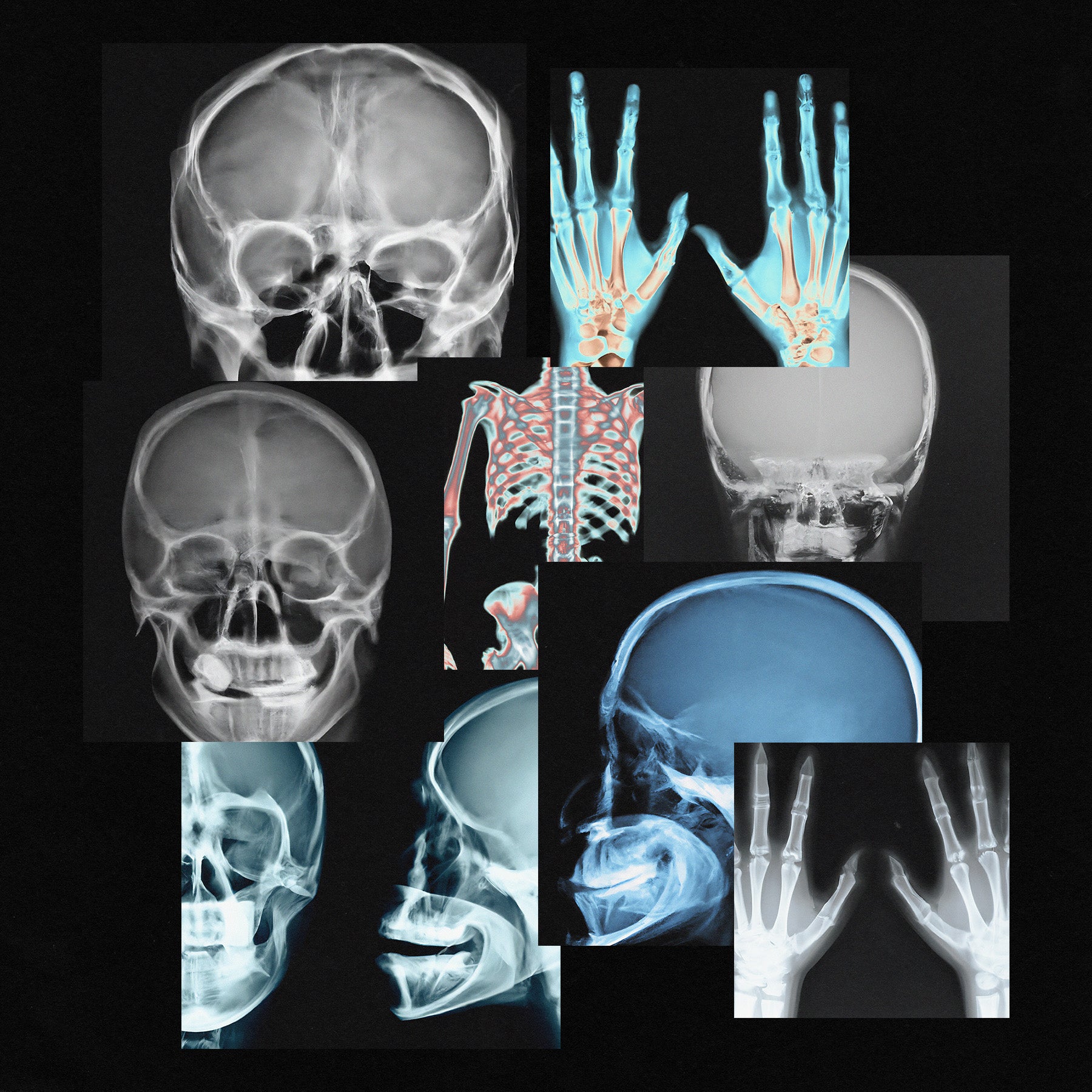 X-RAY SCANS - secret-cache