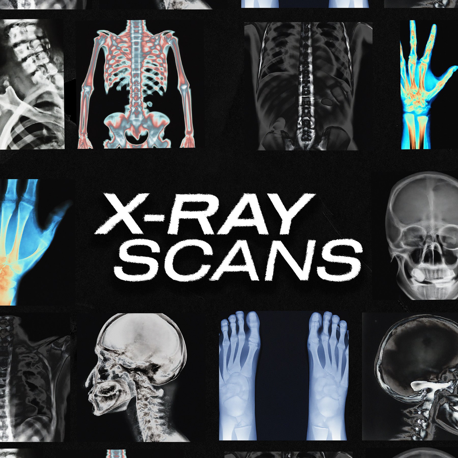 X-RAY SCANS - secret-cache
